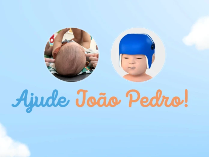 JOÃO PEDRO - CAPACETE ORTOPÉDICO JOÃO PEDRO - CAPACETE ORTOPÉDICO